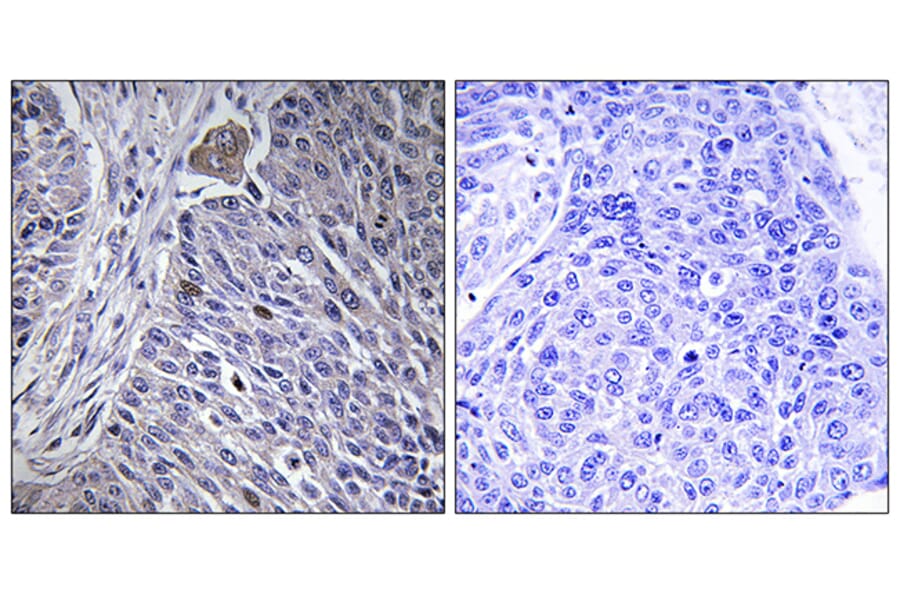 Immunohistochemistry - Anti-HNRPDL Antibody (C16111) - Antibodies.com