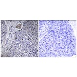 Immunohistochemistry - Anti-HNRPDL Antibody (C16111) - Antibodies.com