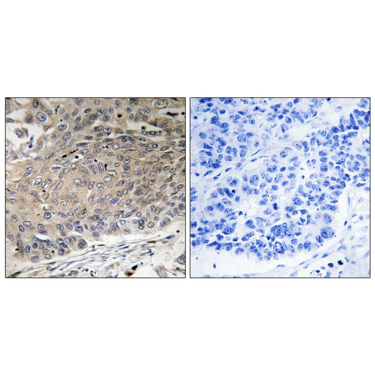 Immunohistochemistry - Anti-DYNLL2 Antibody (C15514) - Antibodies.com