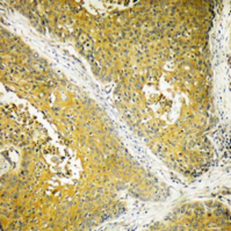 Immunohistochemistry - Anti-DYNLL2 Antibody (C15514) - Antibodies.com