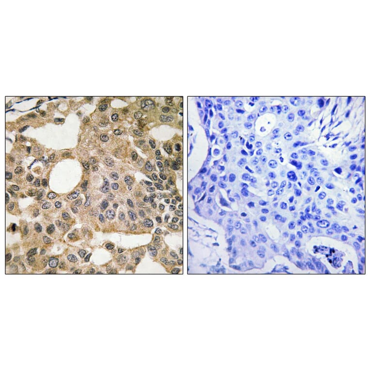Immunohistochemistry - Anti-BCL-XL Antibody (B8243) - Antibodies.com