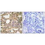 Immunohistochemistry - Anti-BCL-XL Antibody (B8243) - Antibodies.com