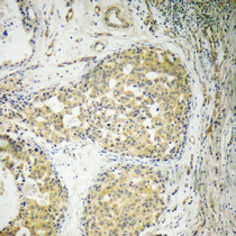 Immunohistochemistry - Anti-BCL-XL Antibody (B8243) - Antibodies.com