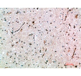 Immunohistochemistry - Anti-AVPR1B Antibody (C31062) - Antibodies.com