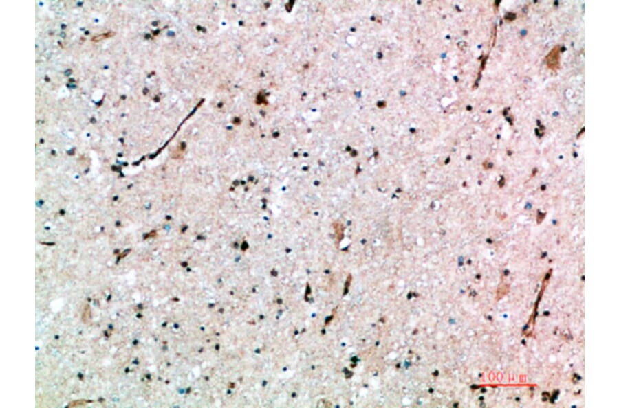 Immunohistochemistry - Anti-AVPR1B Antibody (C31062) - Antibodies.com