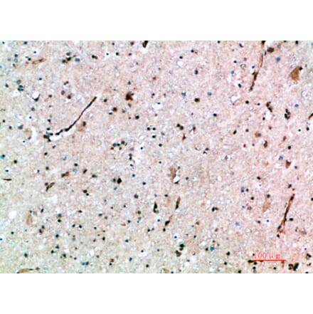 Immunohistochemistry - Anti-AVPR1B Antibody (C31062) - Antibodies.com