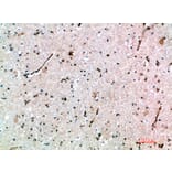 Immunohistochemistry - Anti-AVPR1B Antibody (C31062) - Antibodies.com