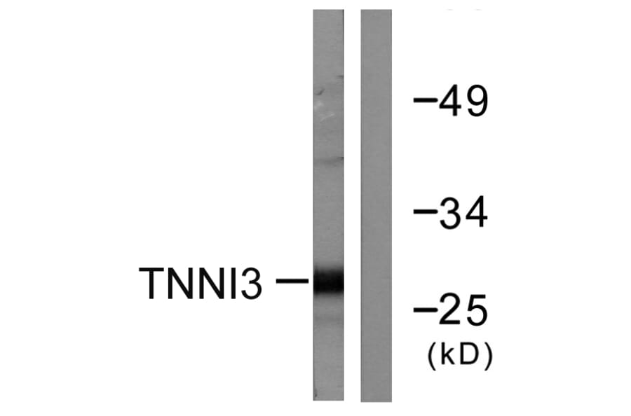 Western Blot - Anti-TNNI3 Antibody (B0587) - Antibodies.com