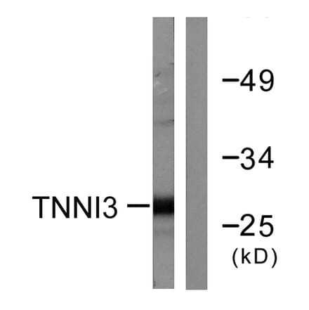 Western Blot - Anti-TNNI3 Antibody (B0587) - Antibodies.com