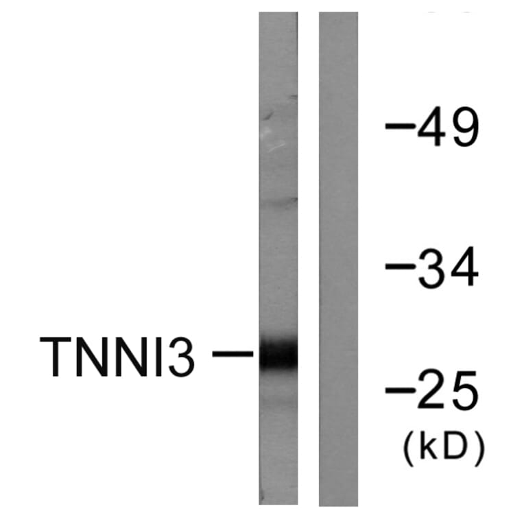 Western Blot - Anti-TNNI3 Antibody (B0587) - Antibodies.com
