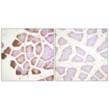 Immunohistochemistry - Anti-TNNI3 Antibody (B0587) - Antibodies.com