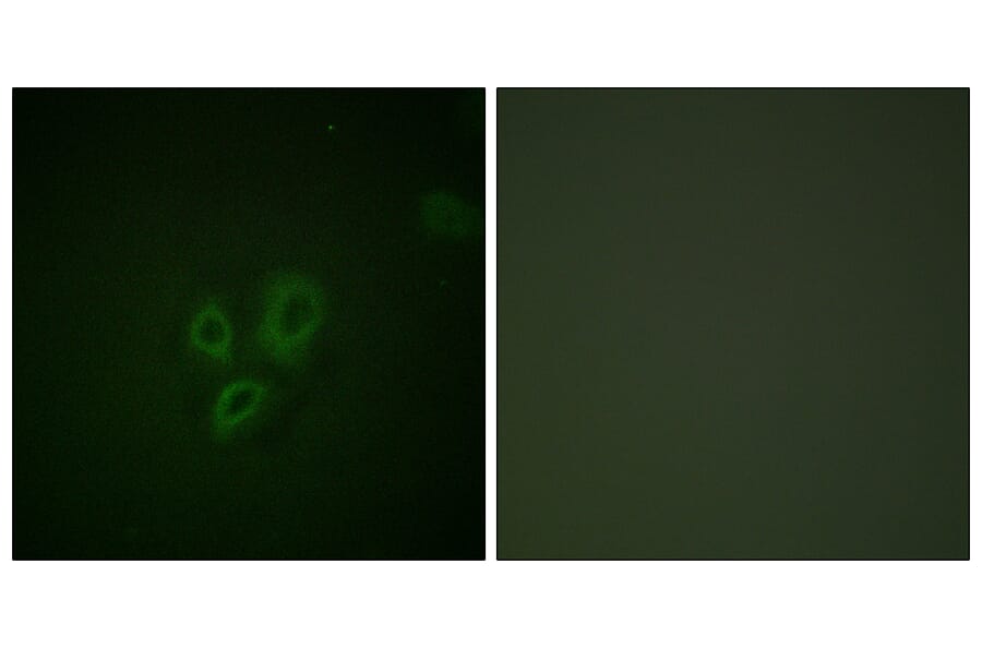 Immunofluorescence - Anti-TNNI3 Antibody (B0587) - Antibodies.com