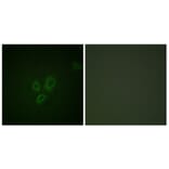 Immunofluorescence - Anti-TNNI3 Antibody (B0587) - Antibodies.com