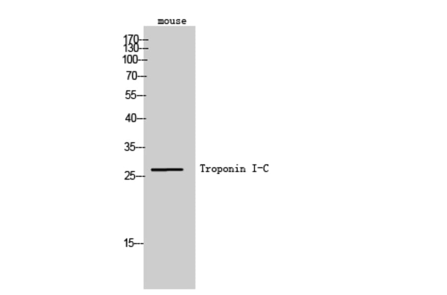 Western Blot - Anti-TNNI3 Antibody (B0587) - Antibodies.com