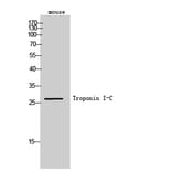 Western Blot - Anti-TNNI3 Antibody (B0587) - Antibodies.com