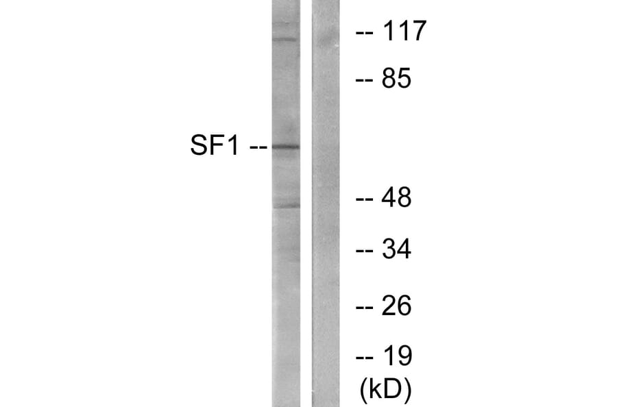 Western Blot - Anti-SF1 Antibody (B0572) - Antibodies.com