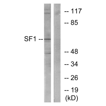 Western Blot - Anti-SF1 Antibody (B0572) - Antibodies.com