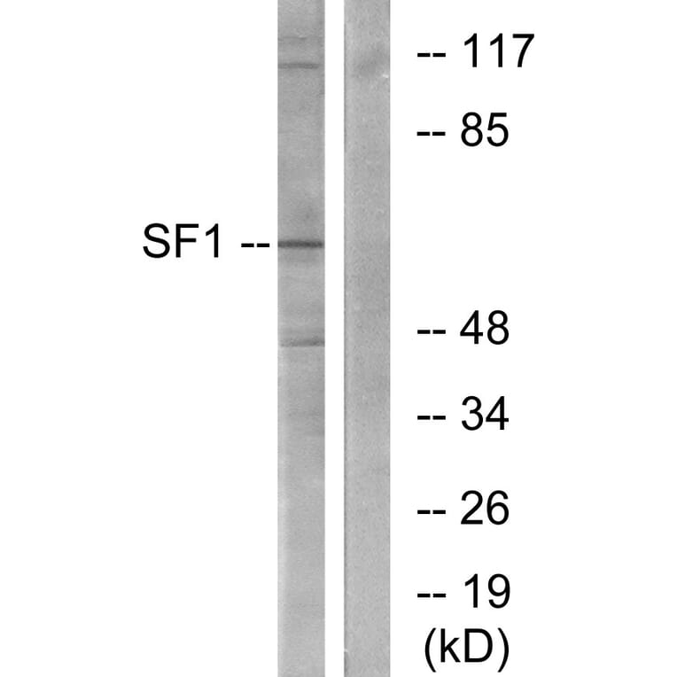 Western Blot - Anti-SF1 Antibody (B0572) - Antibodies.com