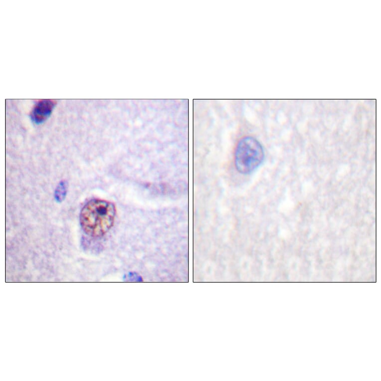 Immunohistochemistry - Anti-SF1 Antibody (B0572) - Antibodies.com