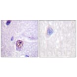 Immunohistochemistry - Anti-SF1 Antibody (B0572) - Antibodies.com