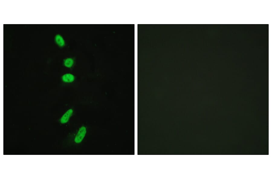 Immunofluorescence - Anti-SF1 Antibody (B0572) - Antibodies.com