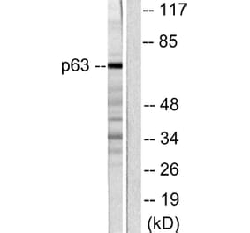 Western Blot - Anti-p63 Antibody (C0292) - Antibodies.com