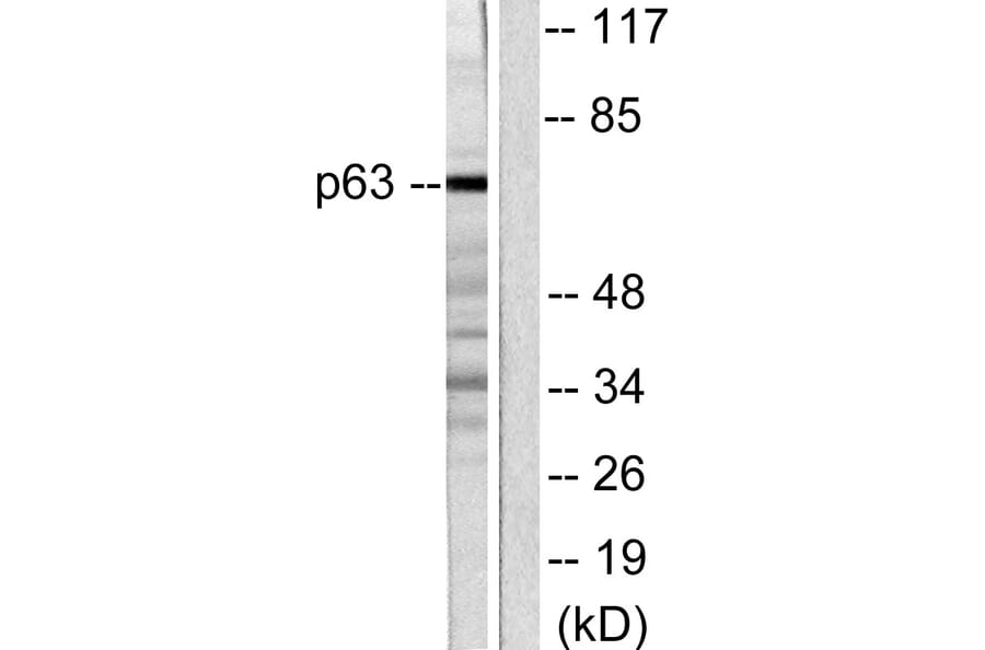 Western Blot - Anti-p63 Antibody (C0292) - Antibodies.com