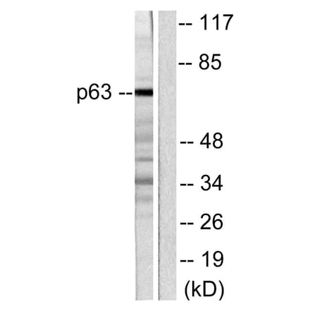 Western Blot - Anti-p63 Antibody (C0292) - Antibodies.com