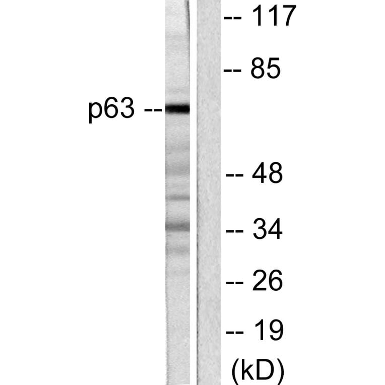 Western Blot - Anti-p63 Antibody (C0292) - Antibodies.com