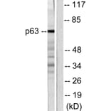 Western Blot - Anti-p63 Antibody (C0292) - Antibodies.com