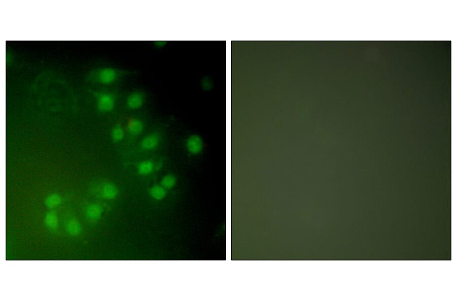 Immunofluorescence - Anti-p63 Antibody (C0292) - Antibodies.com