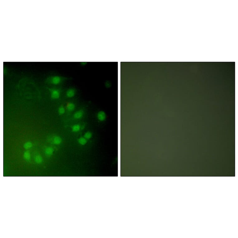Immunofluorescence - Anti-p63 Antibody (C0292) - Antibodies.com