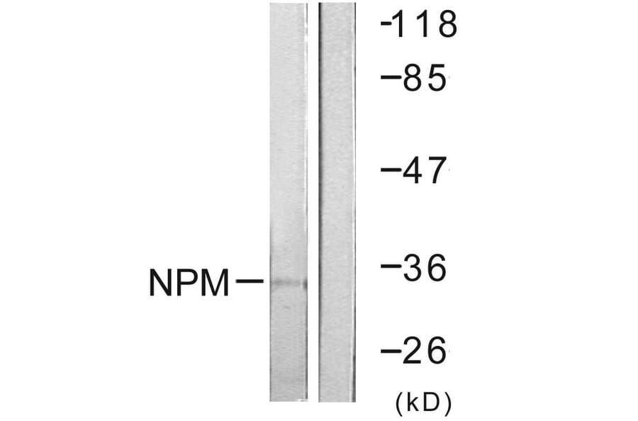 Western Blot - Anti-NPM Antibody (B0694) - Antibodies.com