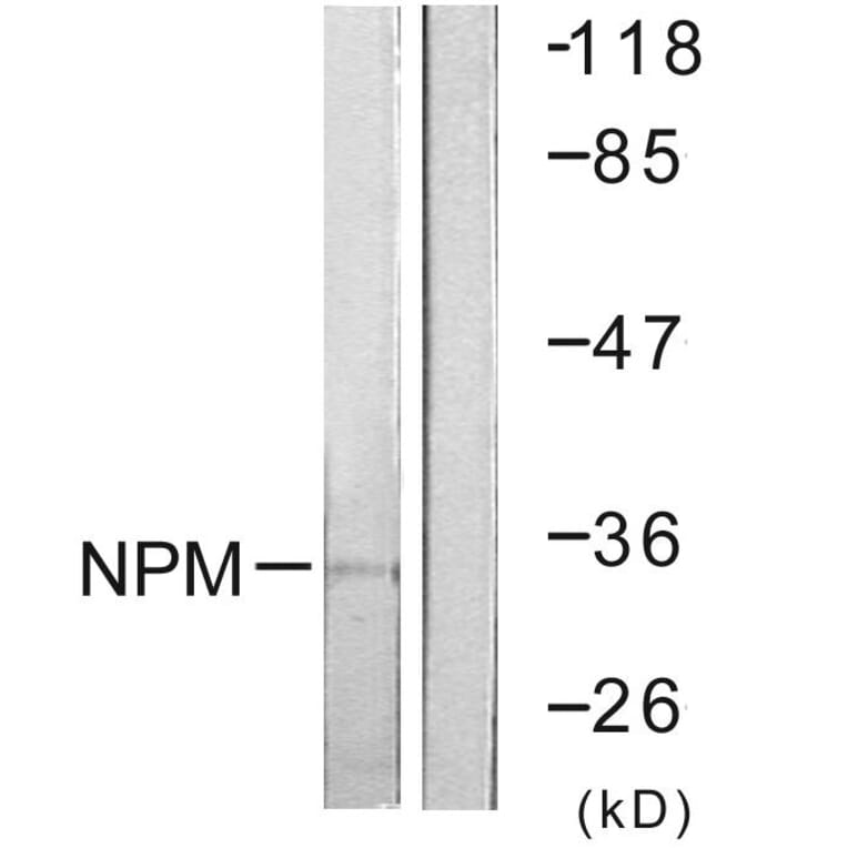 Western Blot - Anti-NPM Antibody (B0694) - Antibodies.com