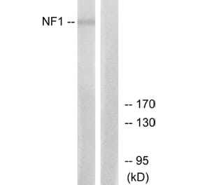 Western Blot - Anti-NF1 Antibody (C13094) - Antibodies.com