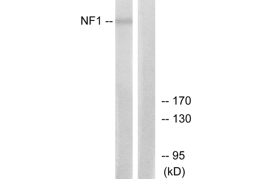 Western Blot - Anti-NF1 Antibody (C13094) - Antibodies.com