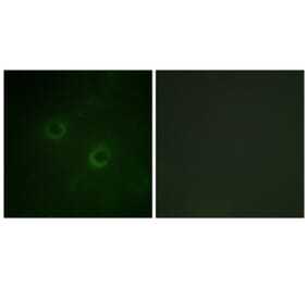 Immunofluorescence - Anti-Lck Antibody (B0506) - Antibodies.com