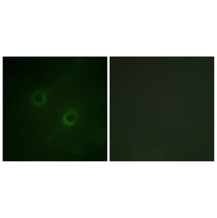 Immunofluorescence - Anti-Lck Antibody (B0506) - Antibodies.com