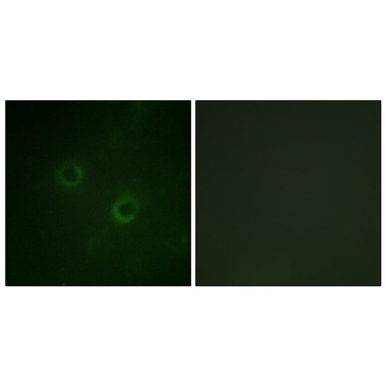 Immunofluorescence - Anti-Lck Antibody (B0506) - Antibodies.com