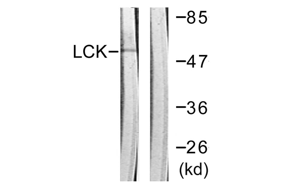 Western Blot - Anti-Lck Antibody (B0506) - Antibodies.com