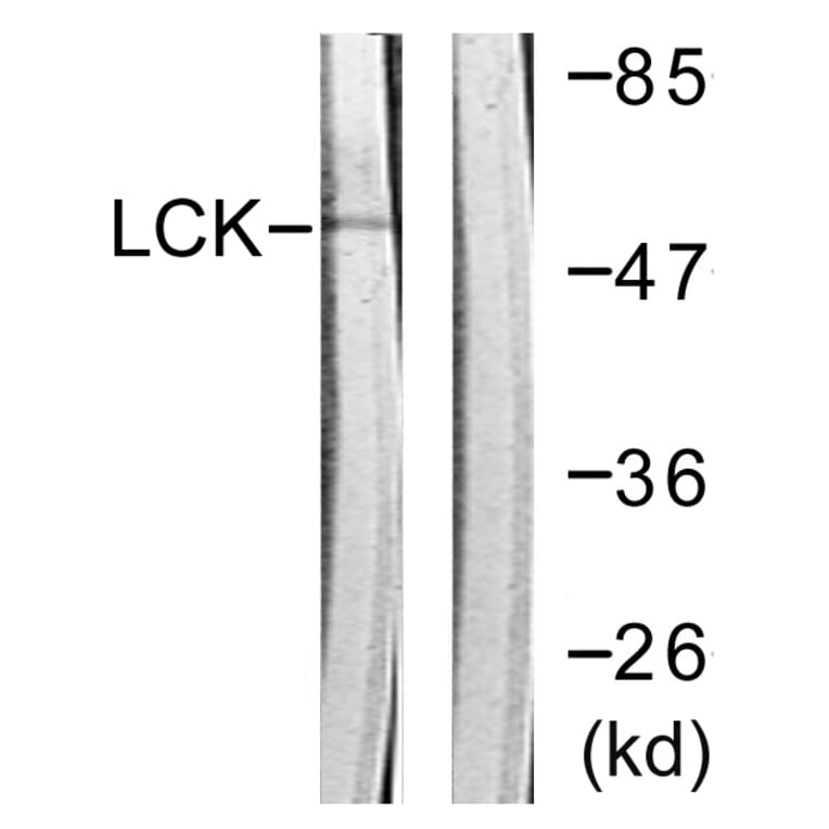 Western Blot - Anti-Lck Antibody (B0506) - Antibodies.com