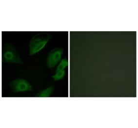 Immunofluorescence - Anti-Lck Antibody (B0505) - Antibodies.com