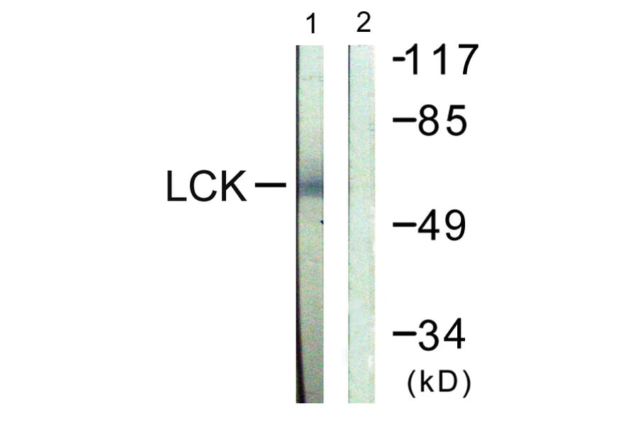 Western Blot - Anti-Lck Antibody (B0505) - Antibodies.com