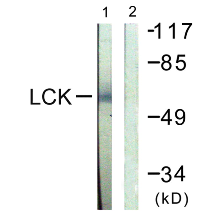Western Blot - Anti-Lck Antibody (B0505) - Antibodies.com