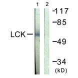 Western Blot - Anti-Lck Antibody (B0505) - Antibodies.com