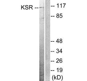 Western Blot - Anti-KSR Antibody (B0075) - Antibodies.com