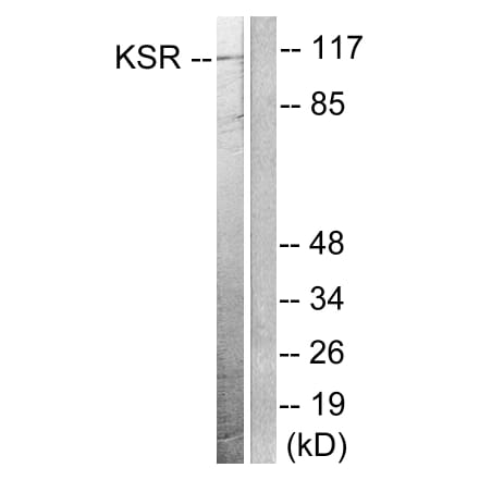 Western Blot - Anti-KSR Antibody (B0075) - Antibodies.com