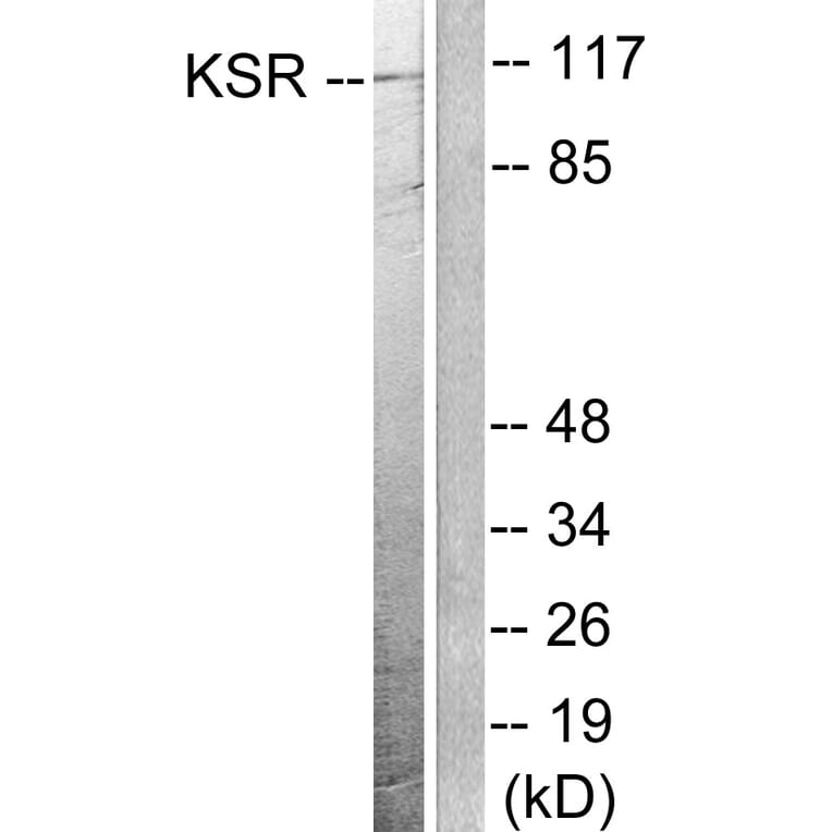 Western Blot - Anti-KSR Antibody (B0075) - Antibodies.com