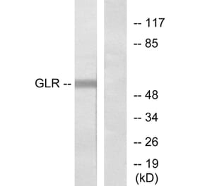Western Blot - Anti-GLR Antibody (G275) - Antibodies.com