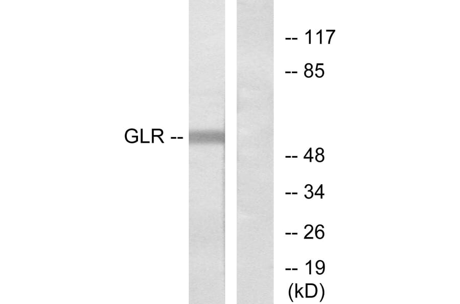 Western Blot - Anti-GLR Antibody (G275) - Antibodies.com